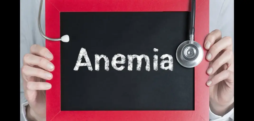 Cómo Vencer la Anemia